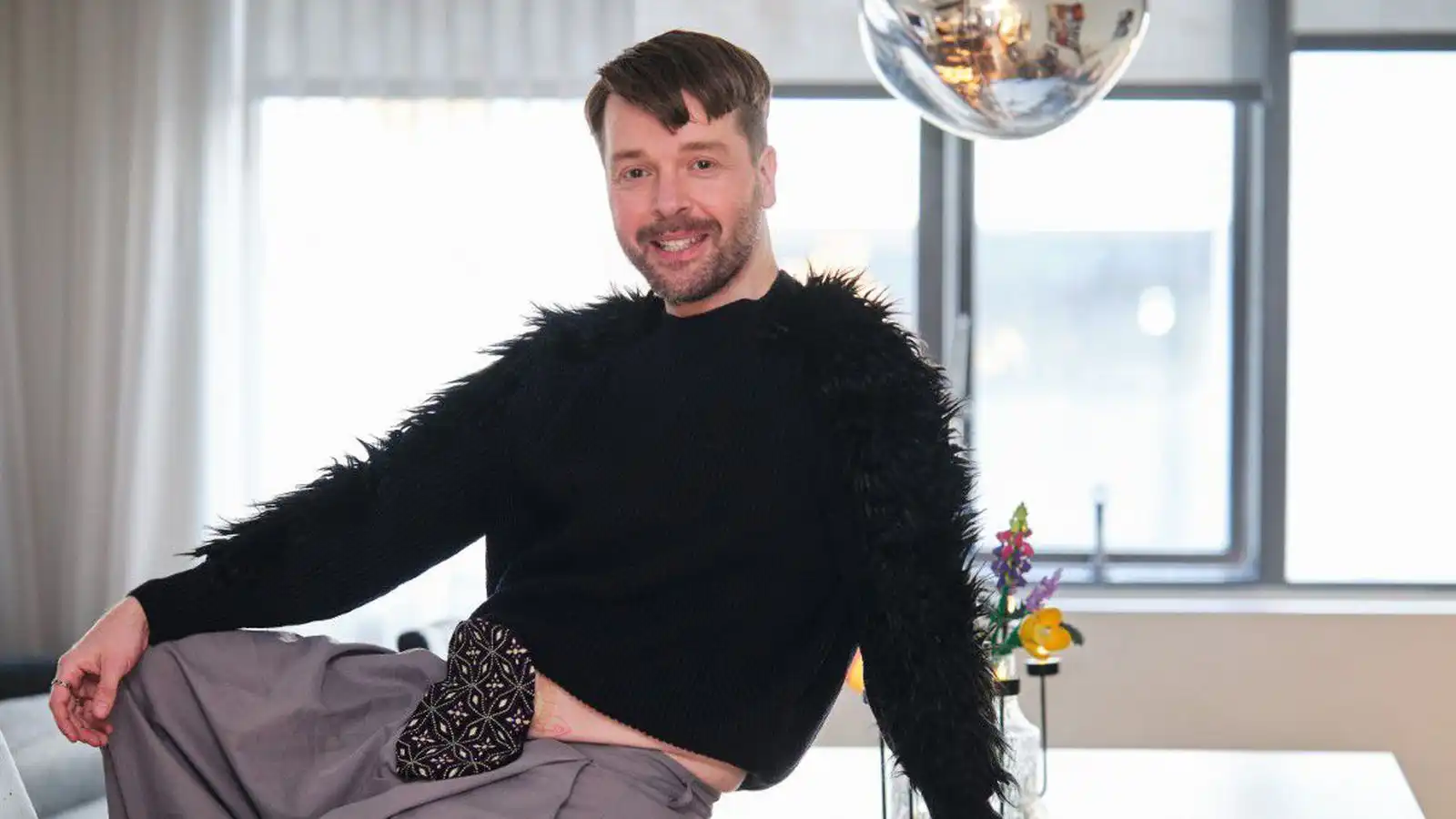 Á­kvað strax að hann ætlaði ekki að fela stómað - Vísir