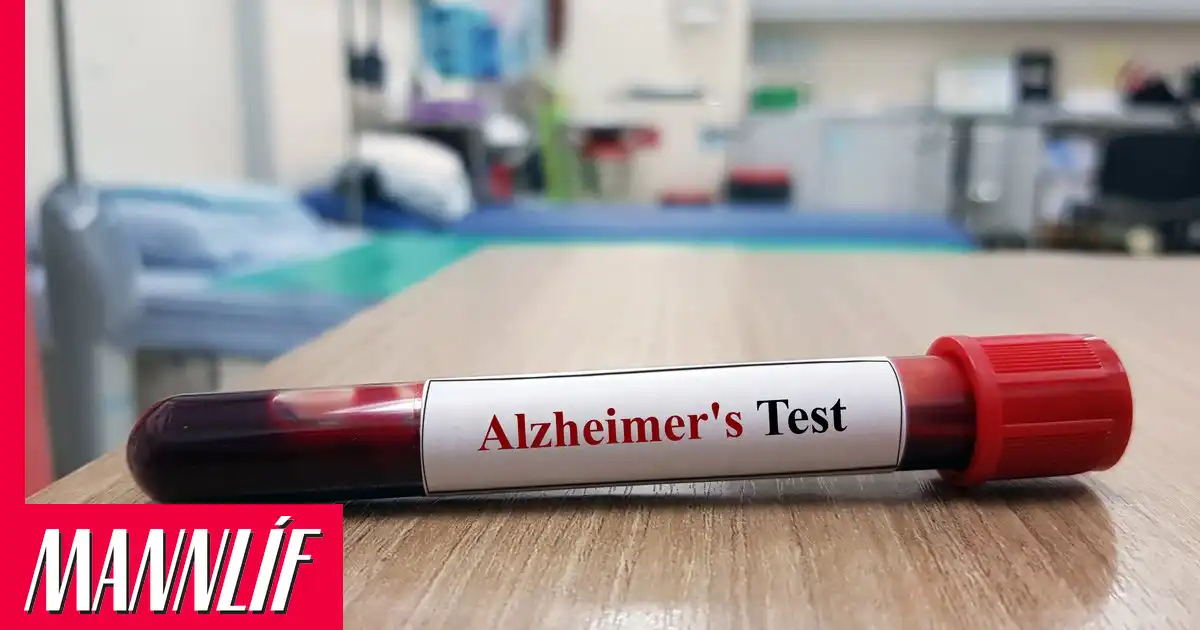Alzheimer-sjúkdómurinn gæti átt upptök sín utan heilans