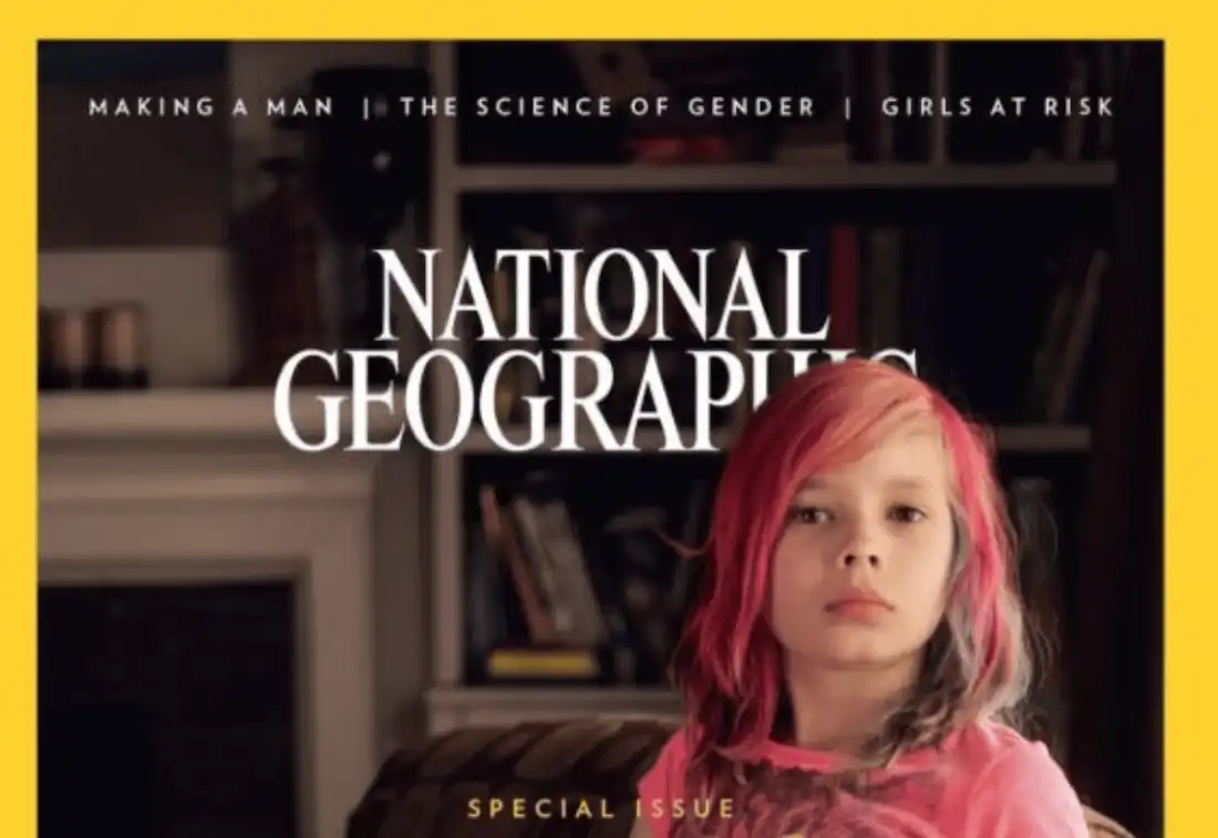 Andlit National Geographic segir transið hafa eiðillagt líf sitt
