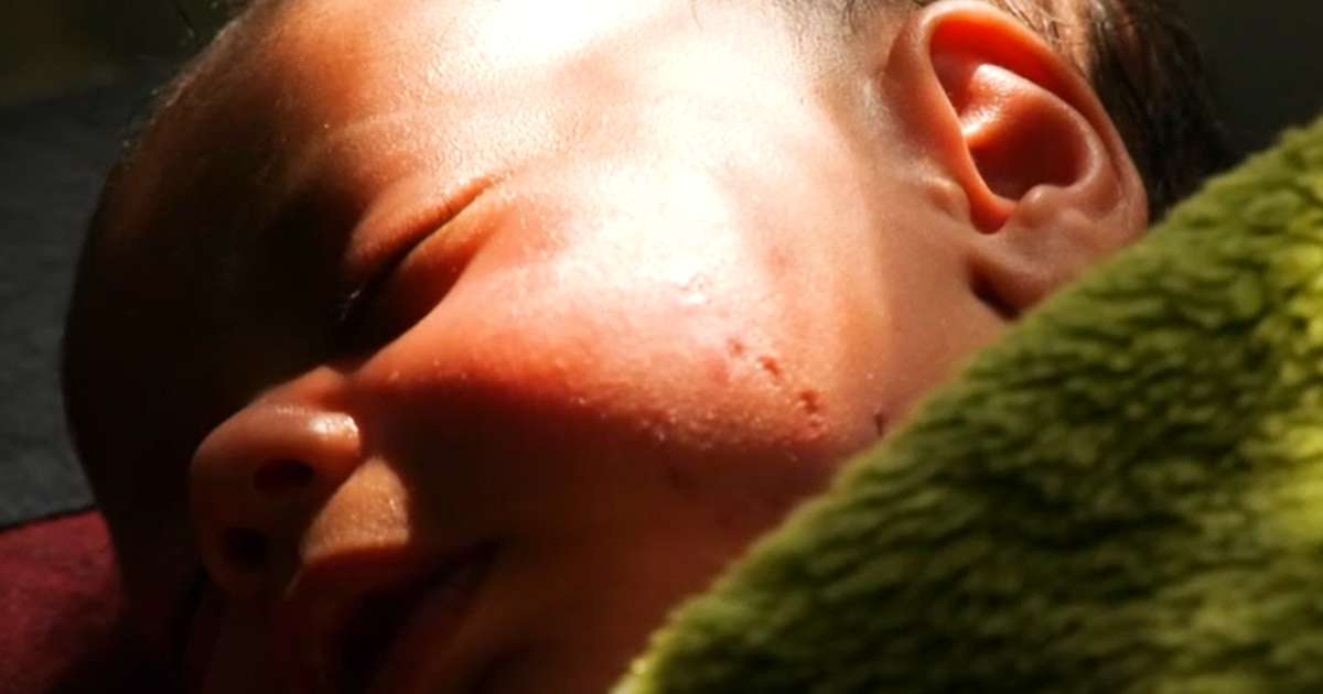 Aukin hætta á mengun á Gaza