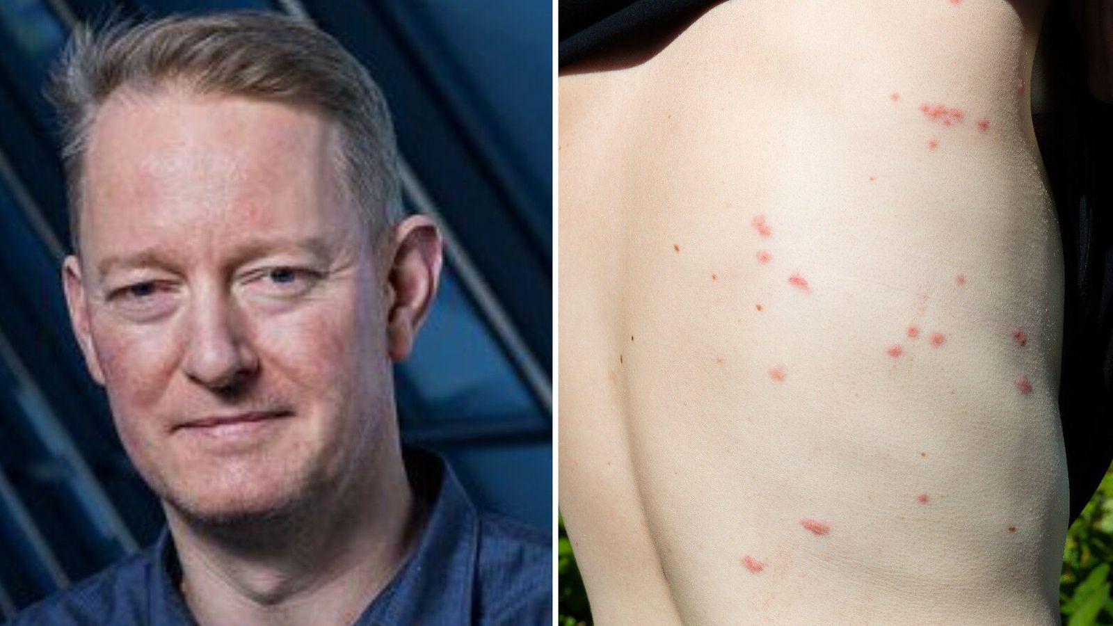 Barist gegn lúsmýinu: „Ein­hvers staðar eru þær að fjölga sér“ - Vísir