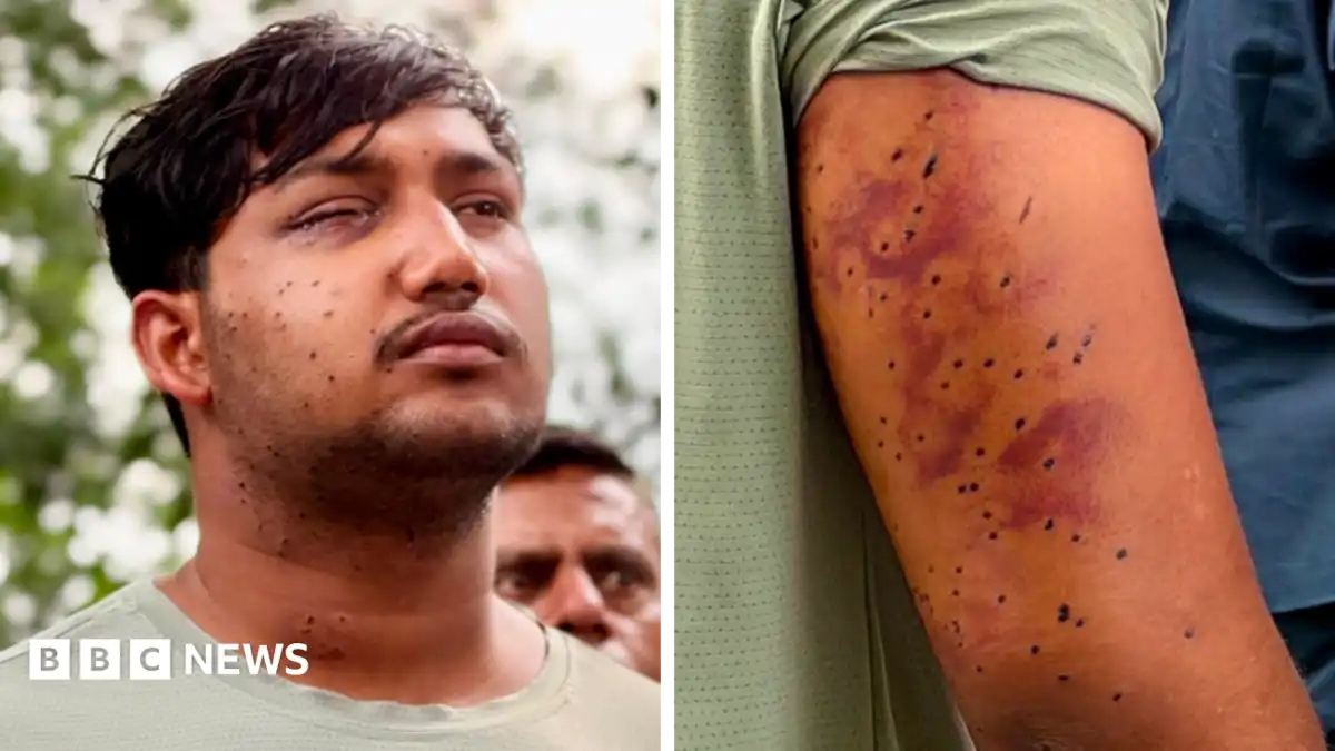CJP protest: India's 'Cockroach' protesters have wounds consistent with pellet-gun fire, experts say