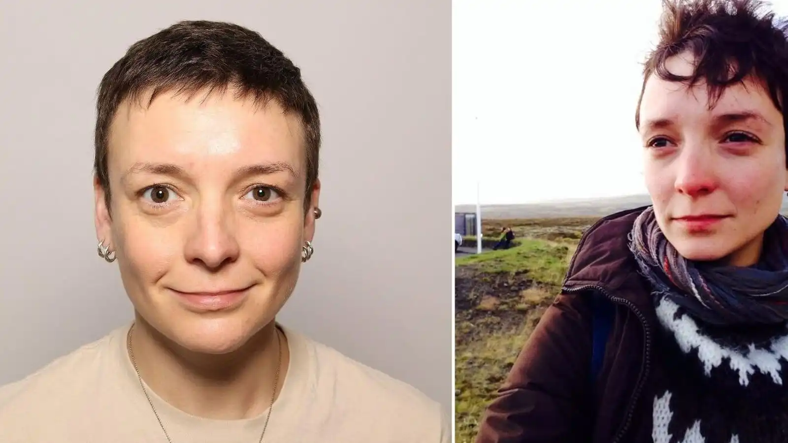 Eins og að vera með kláða sem hverfur aldrei - Vísir