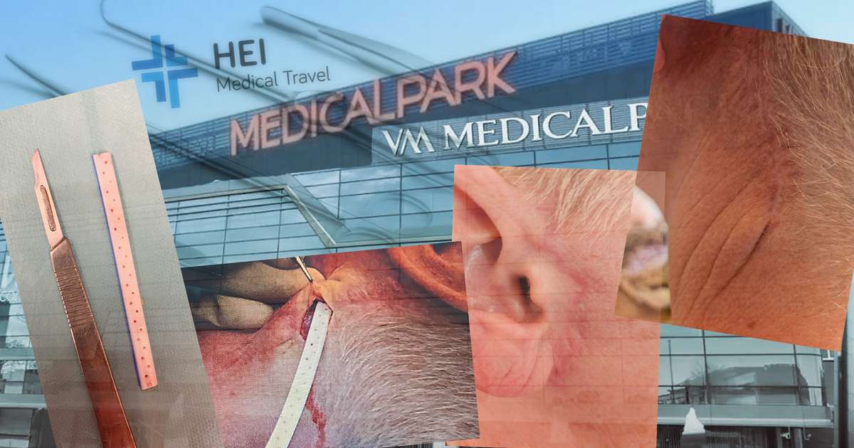 „Ekki eins og þetta sé eftir lýtalækni“