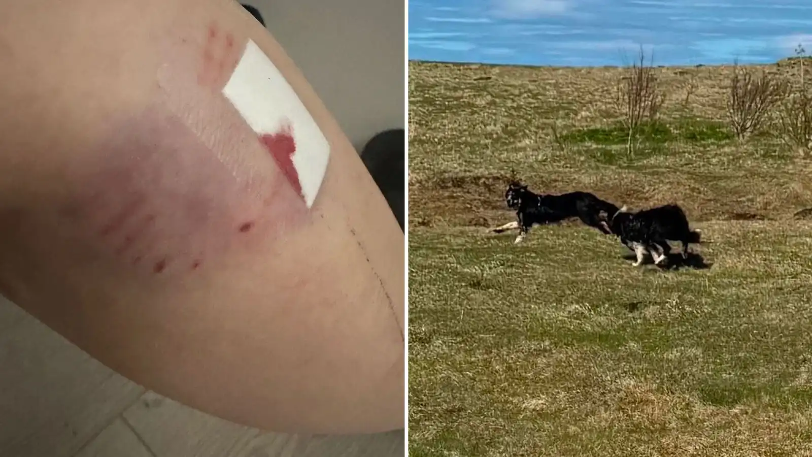 Fleiri bitnir af hundunum - Vísir