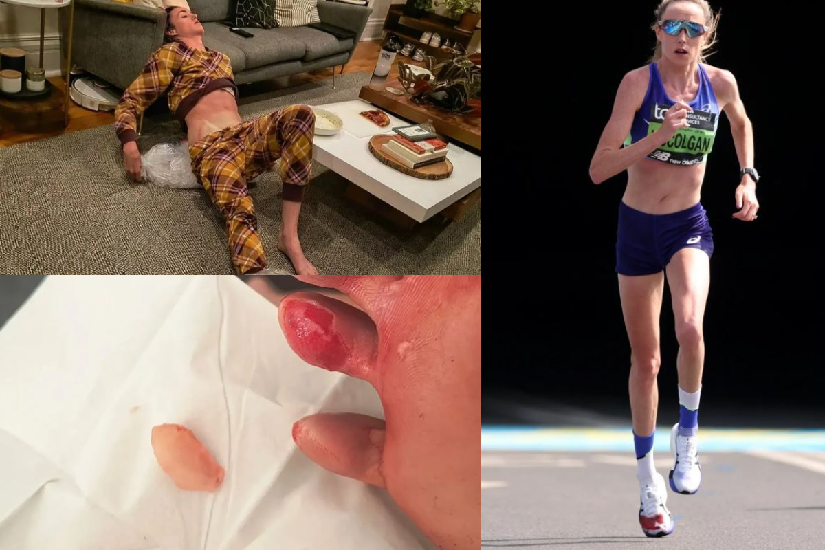 Fótur hlaupakonu í Londonmaraþoninu „sprakk“ – Skórinn alblóðugur - DV