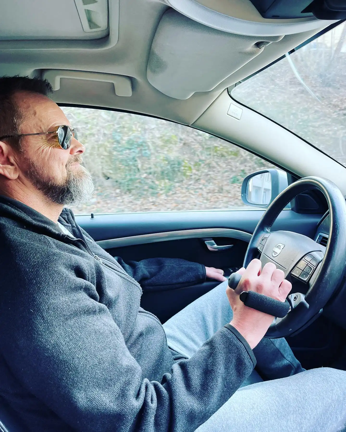 Guðmundur Felix birtir fyrstu myndina eftir aðgerð