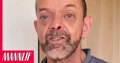 Guðmundur Felix sýnir árangurinn eftir erfiða aðgerð