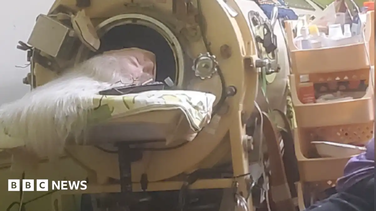 Hours each day in an iron lung kept her breathing, her will to live kept her alive