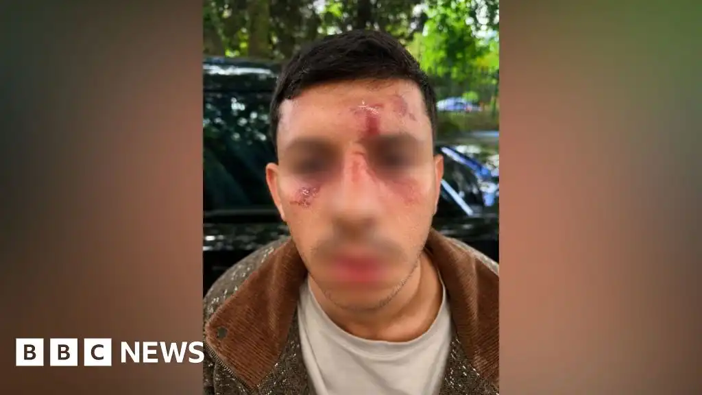 Jewish man 'kicked like animal' as police probe antisemitic attack