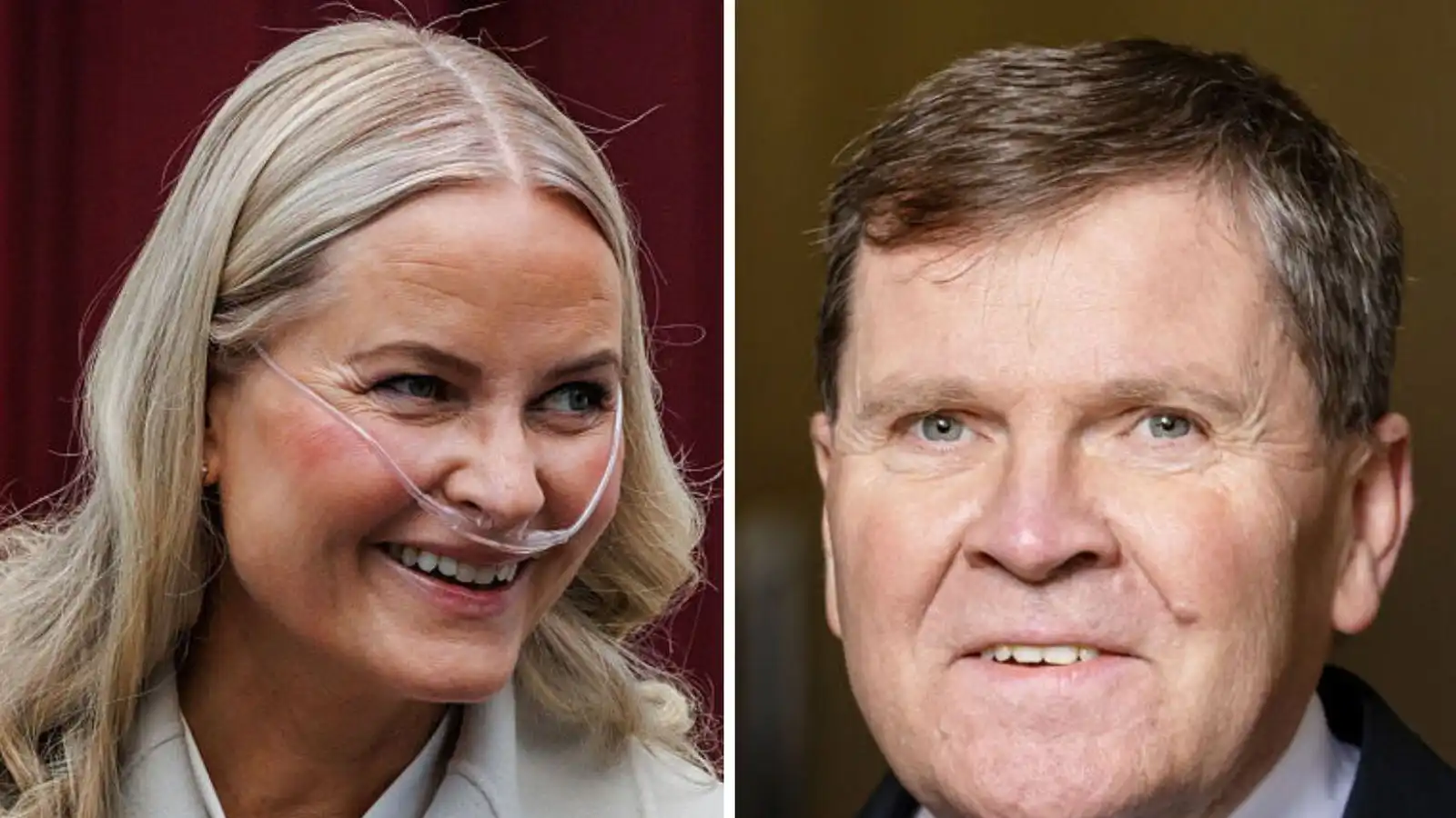 Lungnaígræðsla ekki lækning heldur sjúkdómaskipti - Vísir