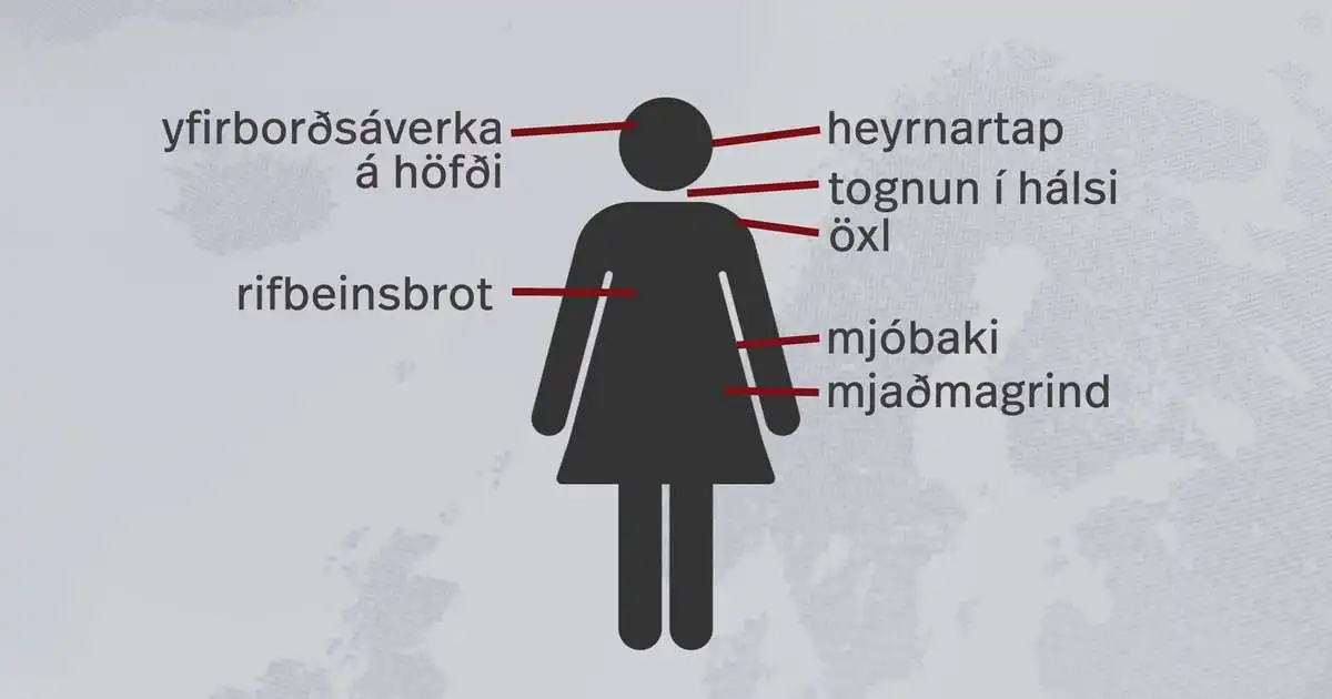 Óttast að búið sé að normalísera ofbeldi í kynlífi með dómi Landsréttar