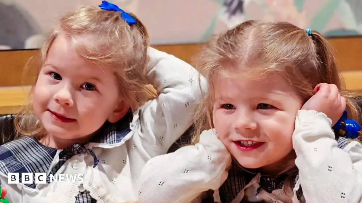 Pioneering treatment saves identical twins from rare pregnancy condition