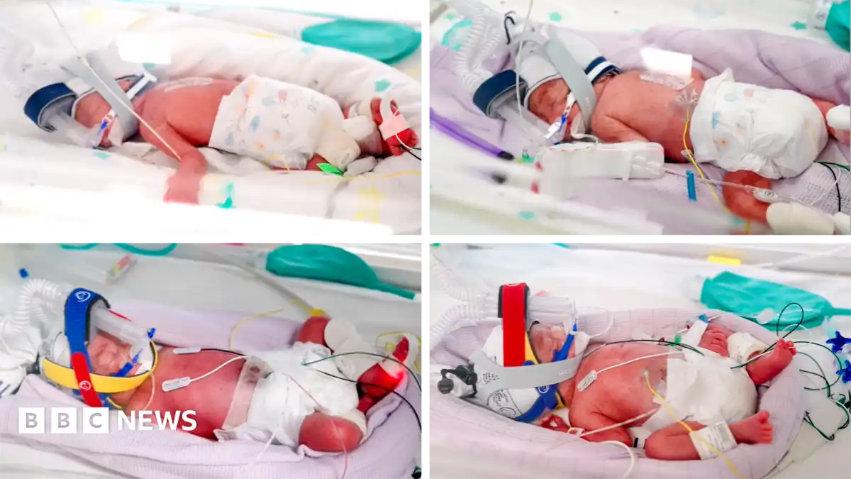 Rare identical quadruplets born in Australia