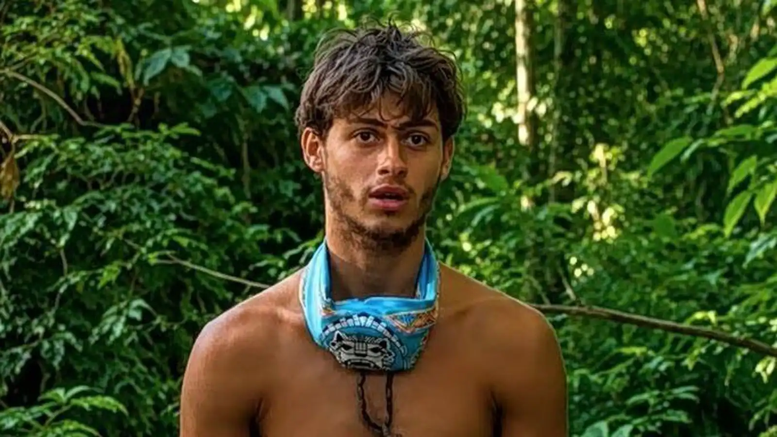 Survivor-keppandi missti fót og krefst 100 milljóna dala í skaða­bætur - Vísir