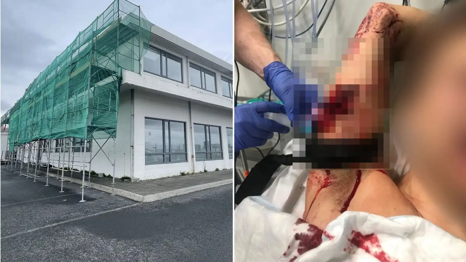 Þriggja ára fangelsi fyrir að frelsissvipta æskuvin sinn - Vísir