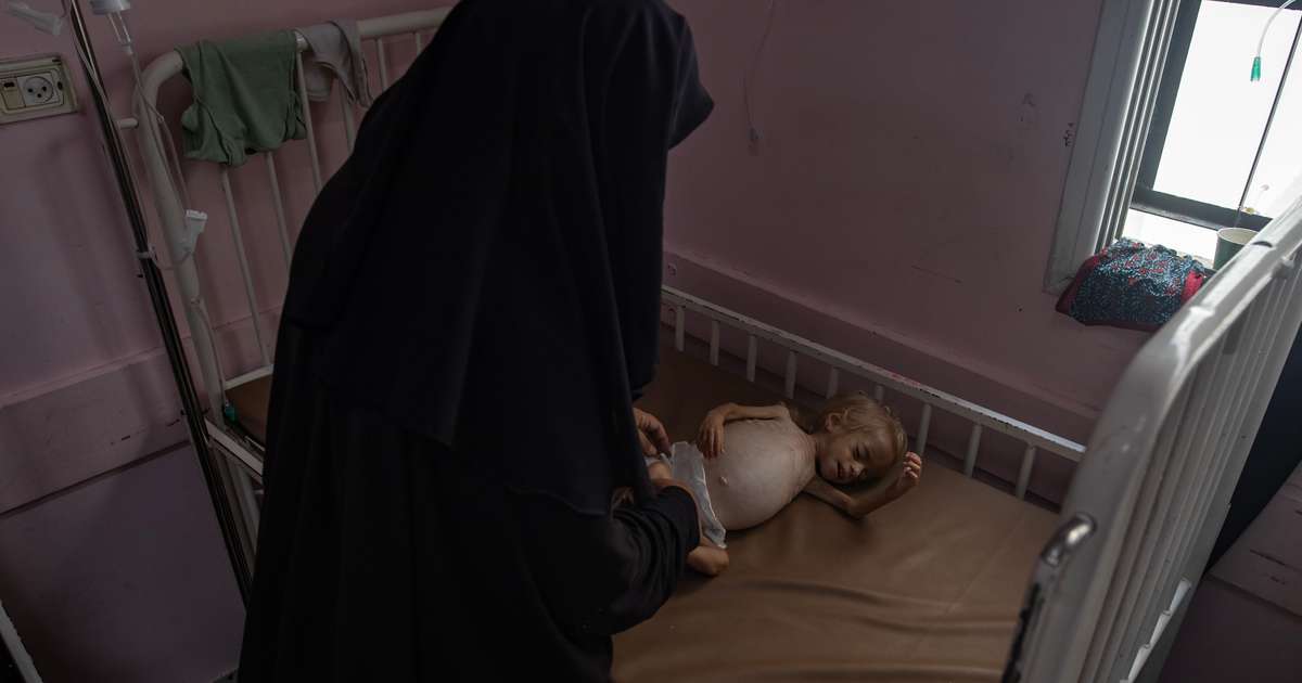 Tveir þriðju hungraðra í heiminum búa í aðeins tíu löndum