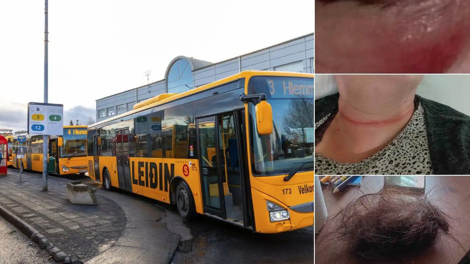 Ung­menni réðust að konu með höggum og spörkum í Mjóddinni - Vísir