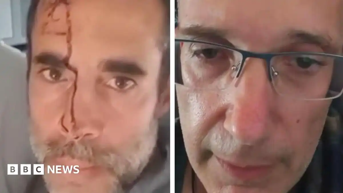 Watch: Passengers describe stabbing on Israel-bound plane